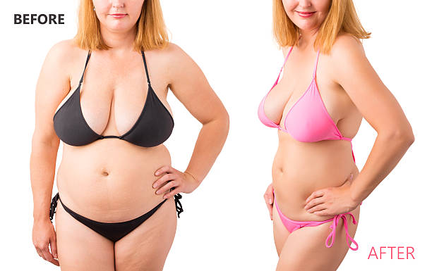 fotografija pre i posle gubitka težine